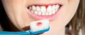 Sundt tandkød bløder ikke, Lindberg Tandlægeklinik